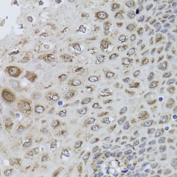 PRKAB1 / AMPK Beta 1 Antibody