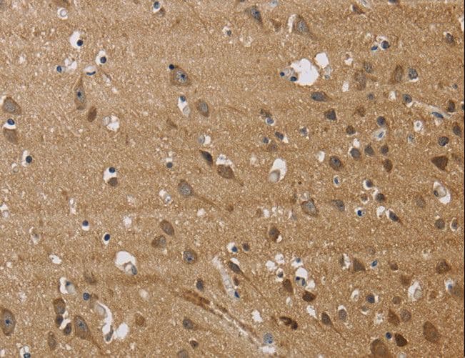JAG1 / Jagged 1 Antibody