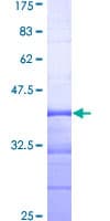 Human NEK8 Protein (Recombinant GST, N-terminus)