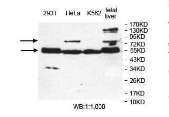Polyclonal Rabbit anti-Human ERO1A / ERO1L Antibody (aa37-189, IHC, WB)