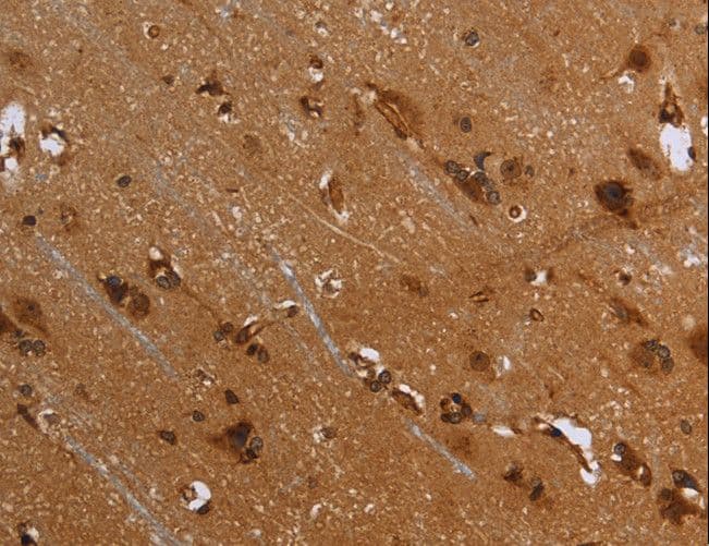 Polyclonal Rabbit anti-Human FLNA / Filamin A Antibody (IHC, WB)