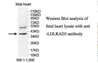 LDLRAD3 Antibody (aa34-161)