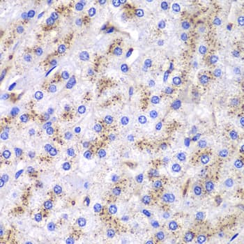 Polyclonal Rabbit anti-Human CTSD / Cathepsin D Antibody (IHC, IF, WB)