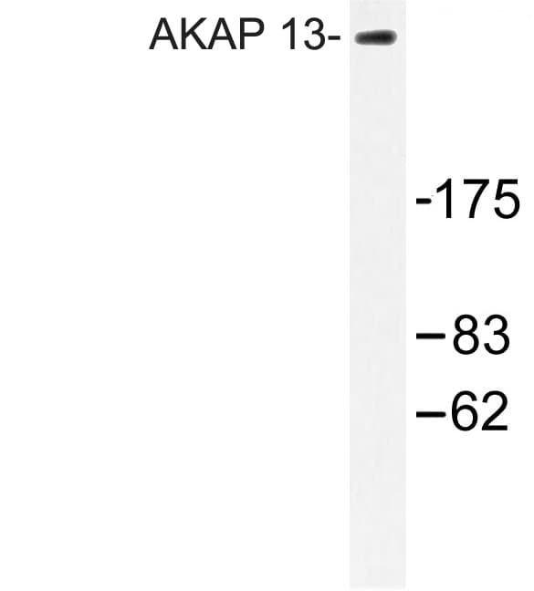Polyclonal Rabbit anti-Human LBC / AKAP13 Antibody (Asp738, IHC, WB)