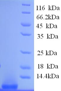 Human GCG / Glucagon Protein (Recombinant His)