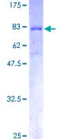 Human FRK Protein (Recombinant GST)