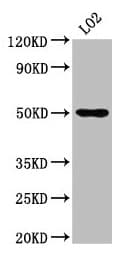 Polyclonal Rabbit anti-Human AGXT2 Antibody (IF, WB)