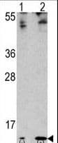 FAU / Fub1 Antibody (aa29-59)