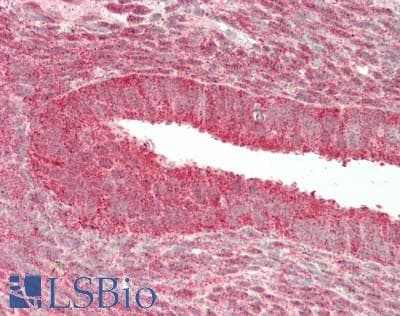 IHC-plus™ Polyclonal Rabbit anti-Mouse DFFA / ICAD / DFF45 Antibody (IHC, IF, WB)
