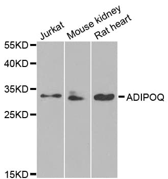 Polyclonal Rabbit anti-Human Adiponectin Antibody (IHC, WB)