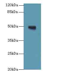 Polyclonal Rabbit anti-Human TUBB1 / Tubulin Beta 1 Antibody (IHC, WB)