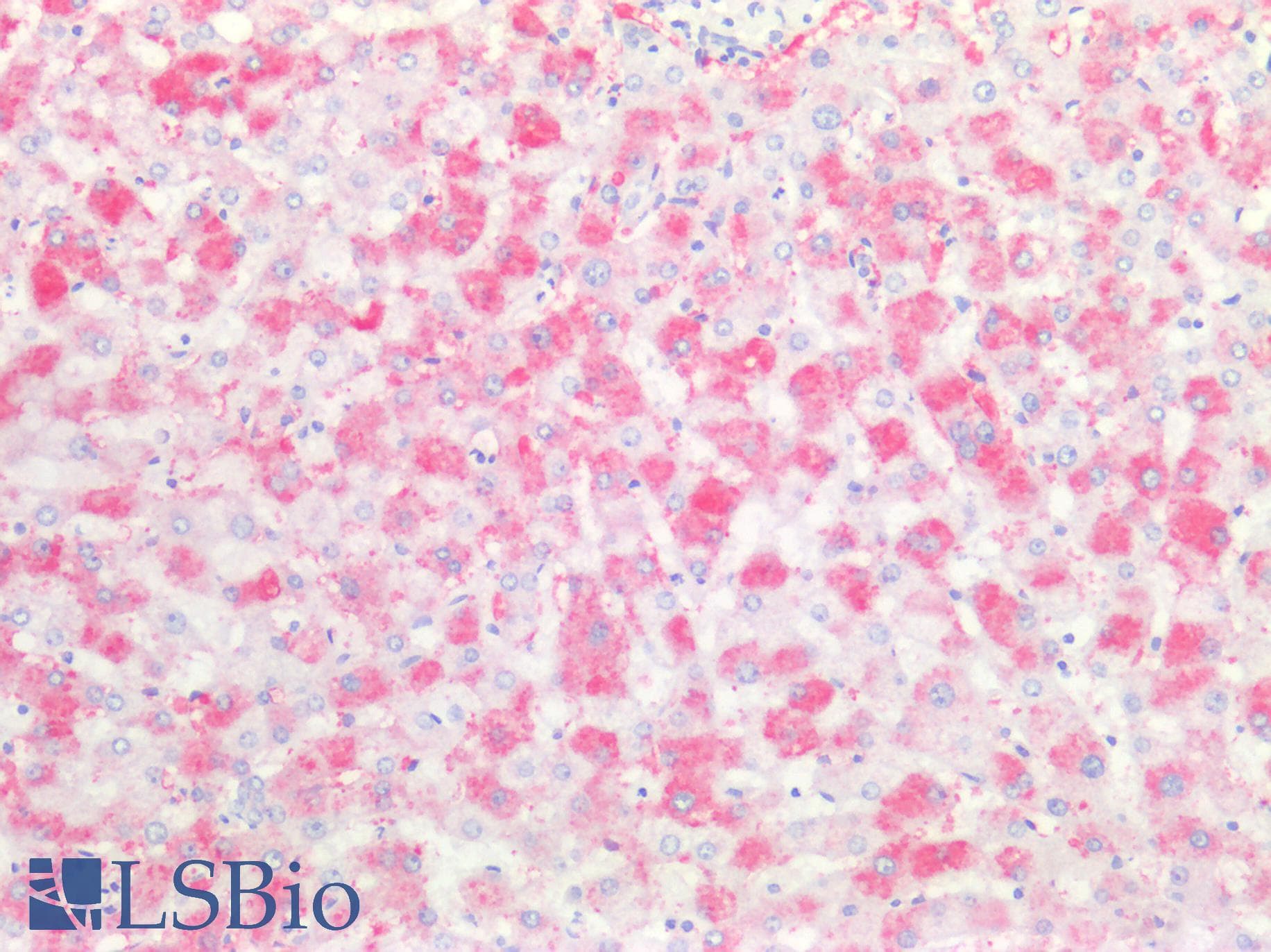 IHC-plus™ F13A1 / Factor XIIIa Antibody