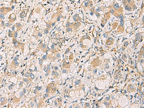 GNAZ Antibody