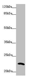 PPIF / Cyclophilin F Antibody