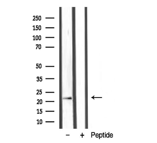 Lymphotoxin-Beta / LTB Antibody