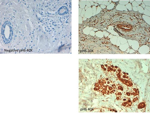 ABCB5 Antibody (Internal)