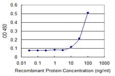 RECQ1 / RECQL Antibody (clone 4D5)
