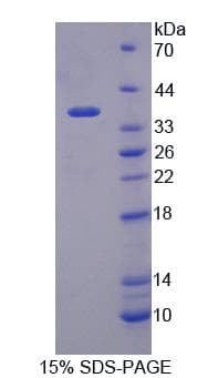 Human MOSC1 Protein (Recombinant His-T7)