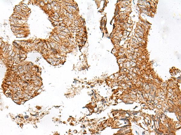GPR119 Antibody