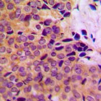 Polyclonal Rabbit anti-Human MMP8 Antibody (C-Terminus, IHC, IF, WB)