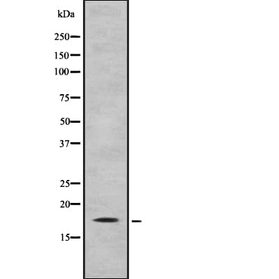 IL31 Antibody