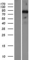 SATB2 Protein (Over-Expression Lysate Myc-DDK (Flag))