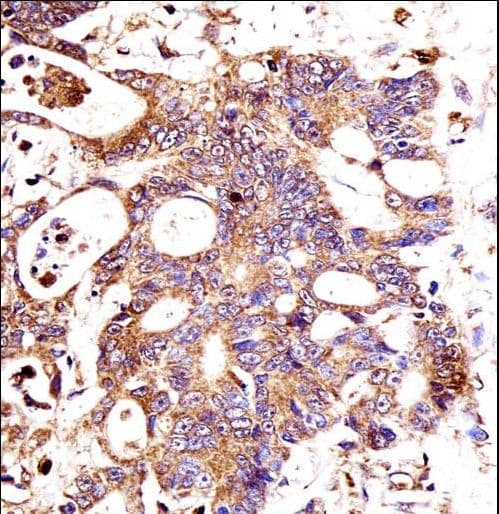 CTNNB1 / Beta Catenin Antibody (aa692-721)