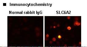 SLC6A2 / NET Antibody (N-Terminal)
