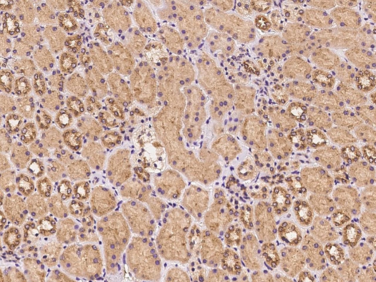 UBXD2 / UBXN4 Antibody