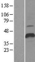 CBLC Protein (Over-Expression Lysate Myc-DDK (Flag))