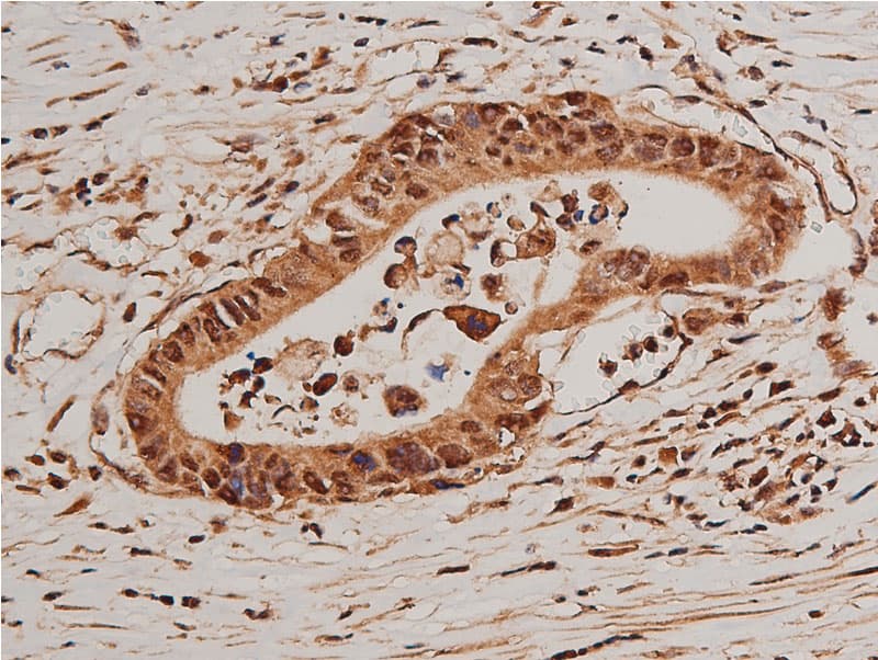 FOXO1 / FKHR Antibody (phospho-Ser319)