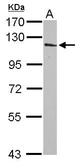 Polyclonal Rabbit anti-Human INPP4A Antibody (Internal, WB)