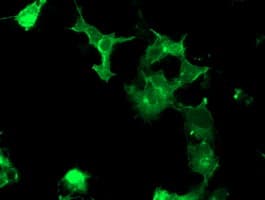 CCK4 / PTK7 Antibody (clone OTI2E7)