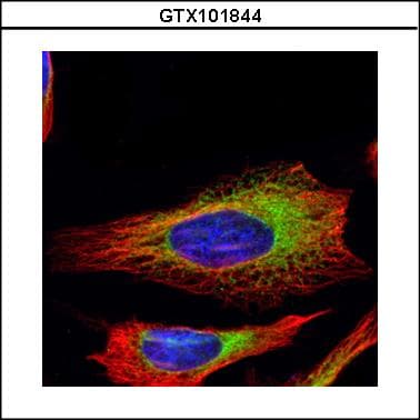Polyclonal Rabbit anti-Human RRBP1 / hES Antibody (aa1183-1410, IHC, WB)