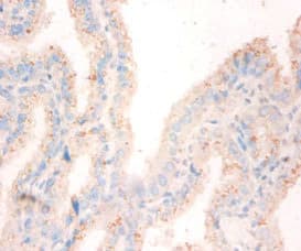 NME1 / NM23 Antibody
