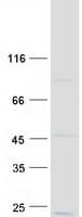 Human NDUFB7 / B18 Protein (Recombinant Myc-DDK (Flag))
