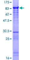 Human ZNF639 Protein (Recombinant GST)