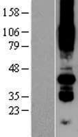 PORCN Protein (Over-Expression Lysate Myc-DDK (Flag))