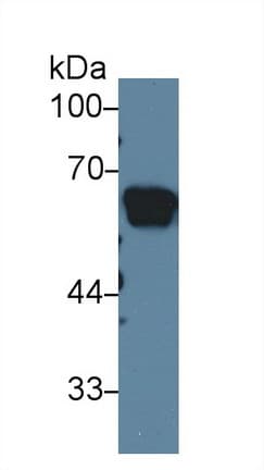 AGT / Angiotensinogen Antibody (aa25-477, APC)