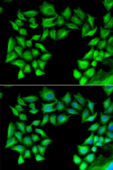 Polyclonal Rabbit anti-Human TIMP4 Antibody (IHC, IF, WB)