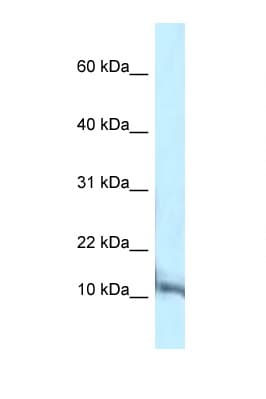 PCBD1 / PHS Antibody (C-Terminus)