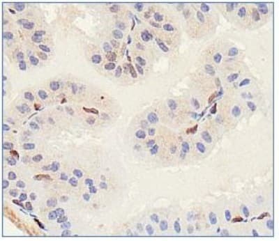 SLITRK1 Antibody
