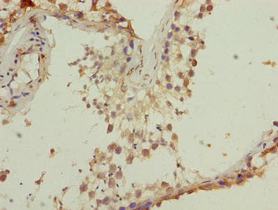 Polyclonal Rabbit anti-Human TMEM140 Antibody (IHC)