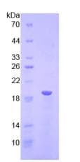Human MBOAT5 / C3F Protein (Recombinant His)