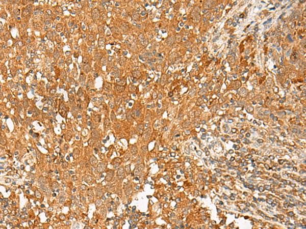 Polyclonal Rabbit anti-Human GPR1 Antibody (IHC)