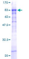Human ZSCAN20 Protein (Recombinant GST)