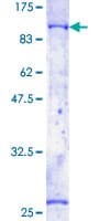 Human BTK Protein (Recombinant GST)