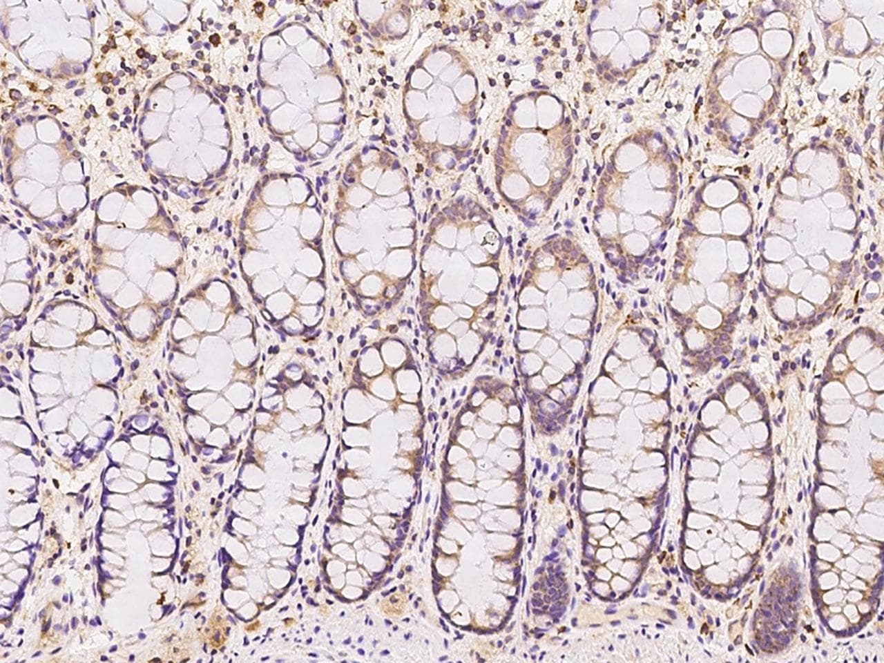 OCIAD1 Antibody