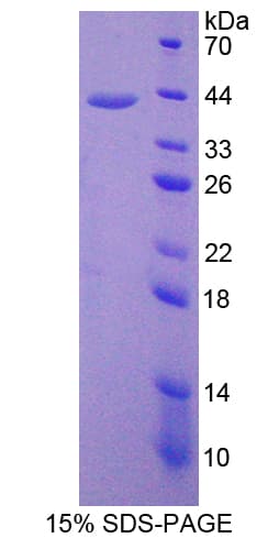 Rat ADAP2 / CENTA2 Protein (Recombinant His-T7)