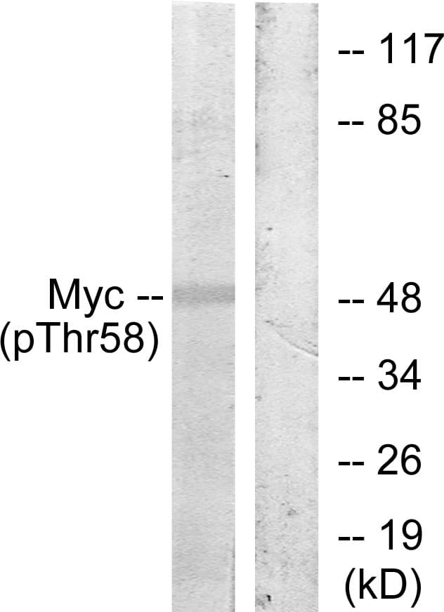 Polyclonal Rabbit anti-Human MYC / c-Myc Antibody (phospho-Thr58, IHC, WB)